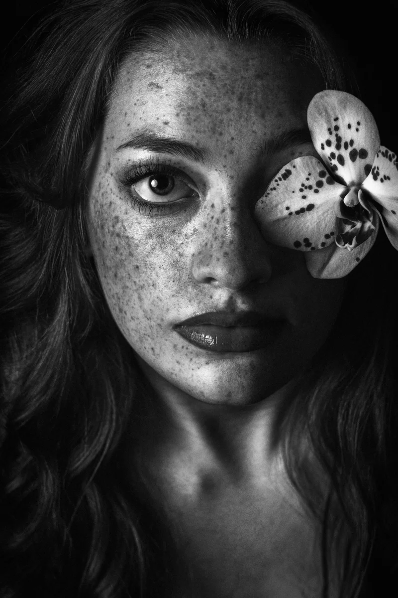 Heavily freckled woman with an orchid covering one eye